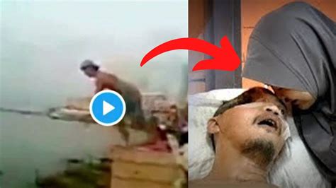 He trips and lands on the concrete slab where fishermen are fishing rather than on the water. . Split face diving accident